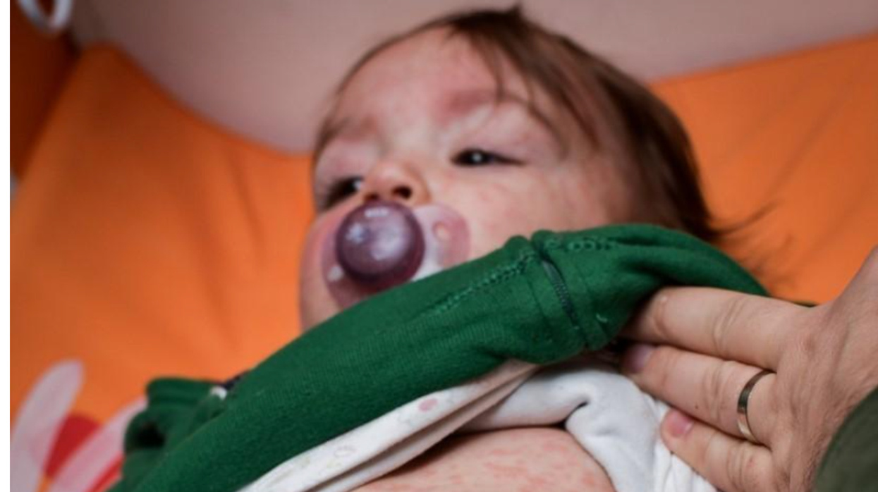 GOP Legislators Undermine Public Health As Measles Spreads Across 15 States