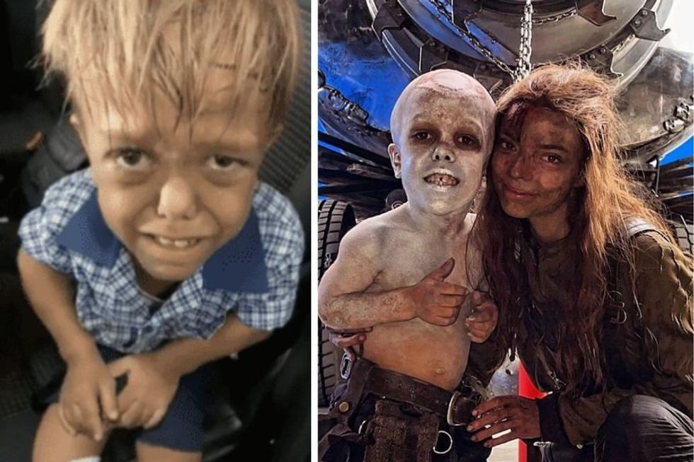 Kid who went viral for being bullied for dwarfism gets amazing role in new 'Mad Max' movie