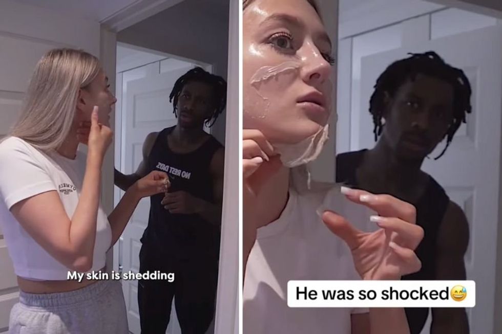 Woman pranks man into thinking skin shedding is a common PMS symptom and it's comedy gold