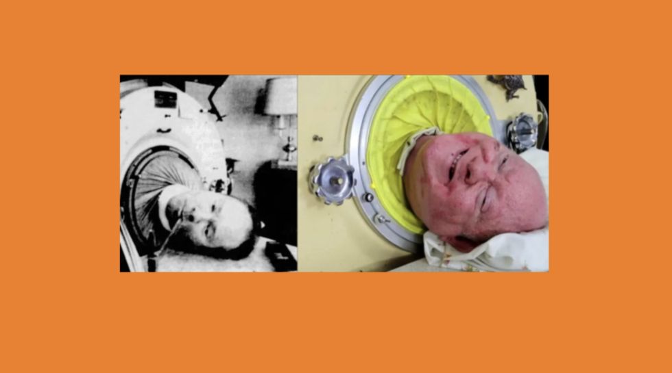 Paul Alexander spent over 70 years in an iron lung. What he was able to accomplish is amazing.
