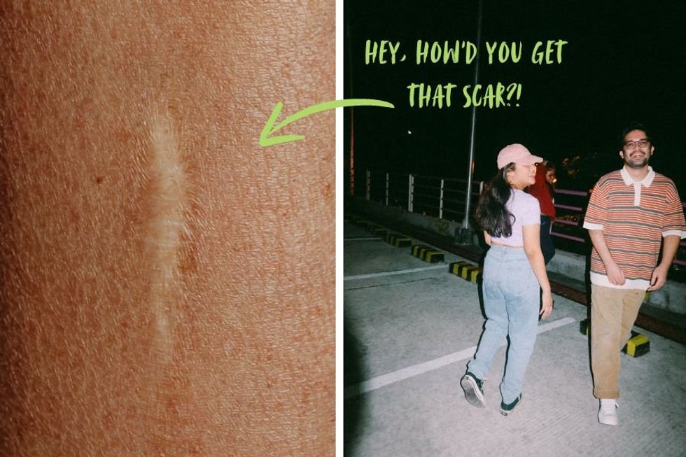 Millennial asks Gen X people how they got their scars and the responses are unbelievable