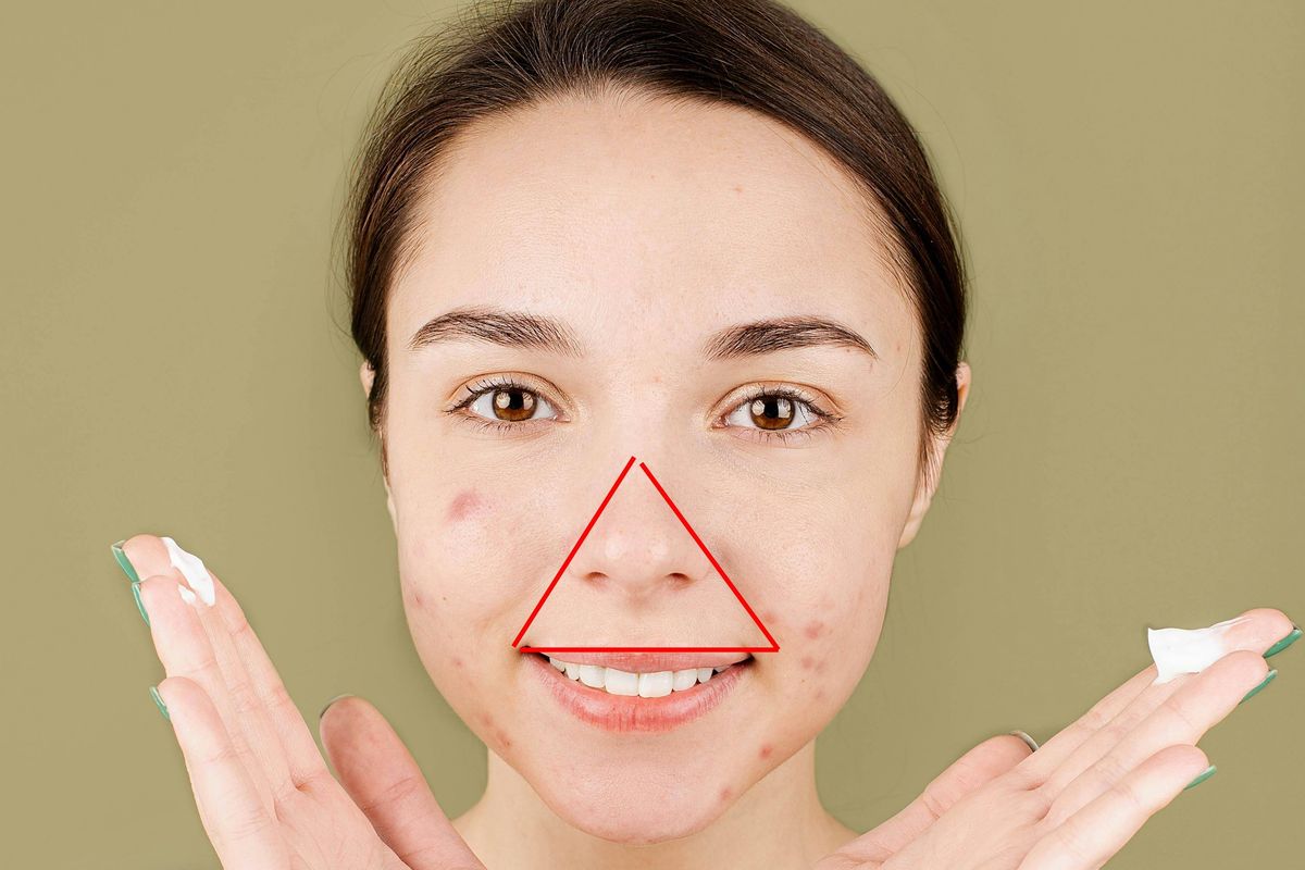 triangle of death, popping pimples, doctors