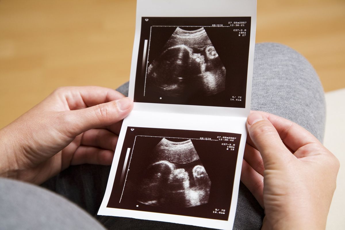 Solo in una società ipocrita e perversa sopprimere un bimbo non è un omicidio