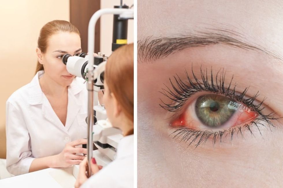 Optometrists warn people against waterproof mascara due to the risk of unsightly eye damage