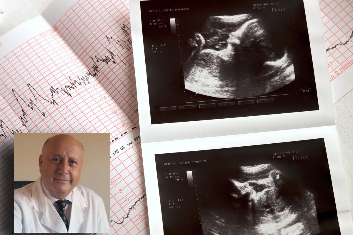 «Con la sindrome di Down l’aborto è regola»