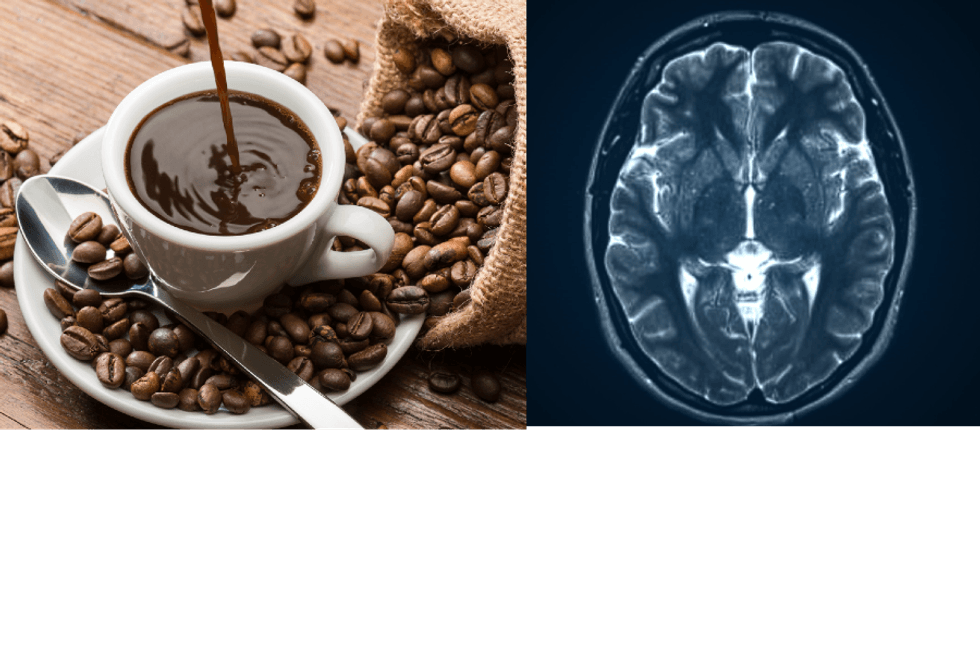 Scientific study suggests black coffee reduces risk of Alzheimer’s and Parkinson’s disease