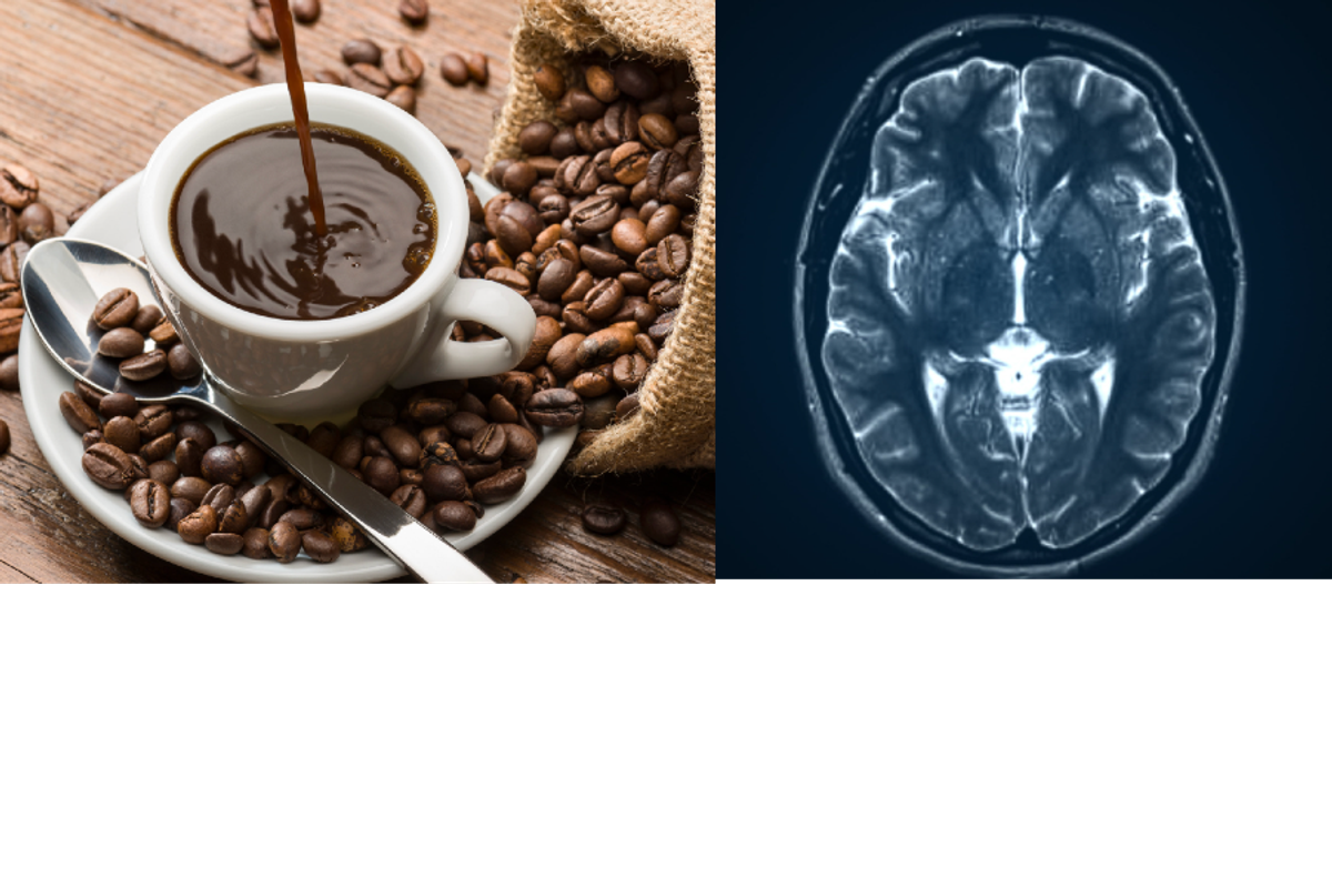 Cup of coffee surrounded by beans next to a brain scan