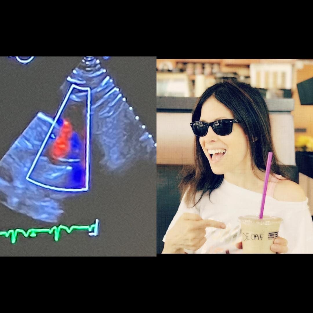 I had a couple of months to live and what I'm grateful for is not what you'd think