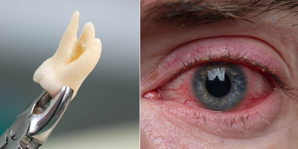 Impossible-sounding surgery cures blindness by implanting a patient's own tooth in their eye - Upworthy