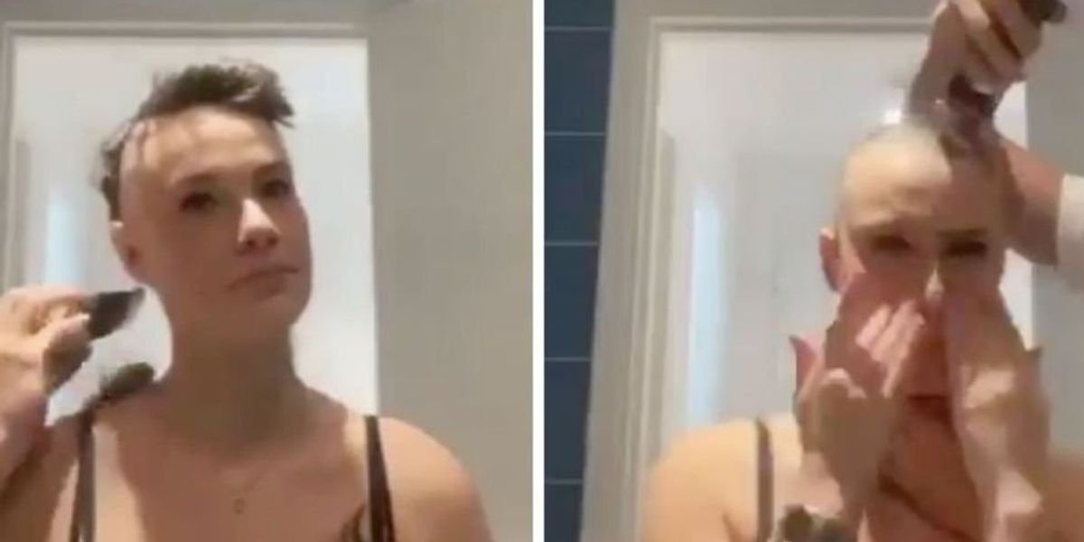 Man Shaves Head with Girlfriend's Alopecia - News Directory 3