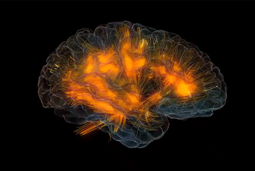 brain scan, scan, brain,