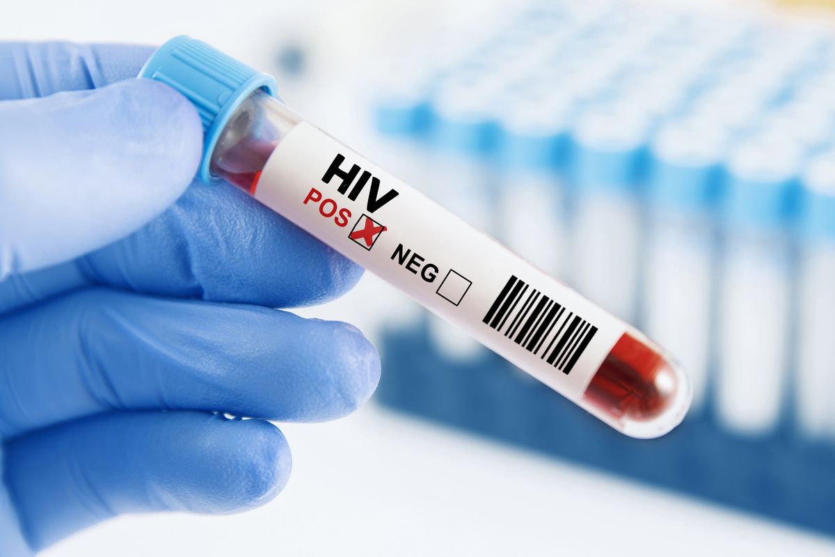 Dopo la pandemia crescono le diagnosi di Hiv
