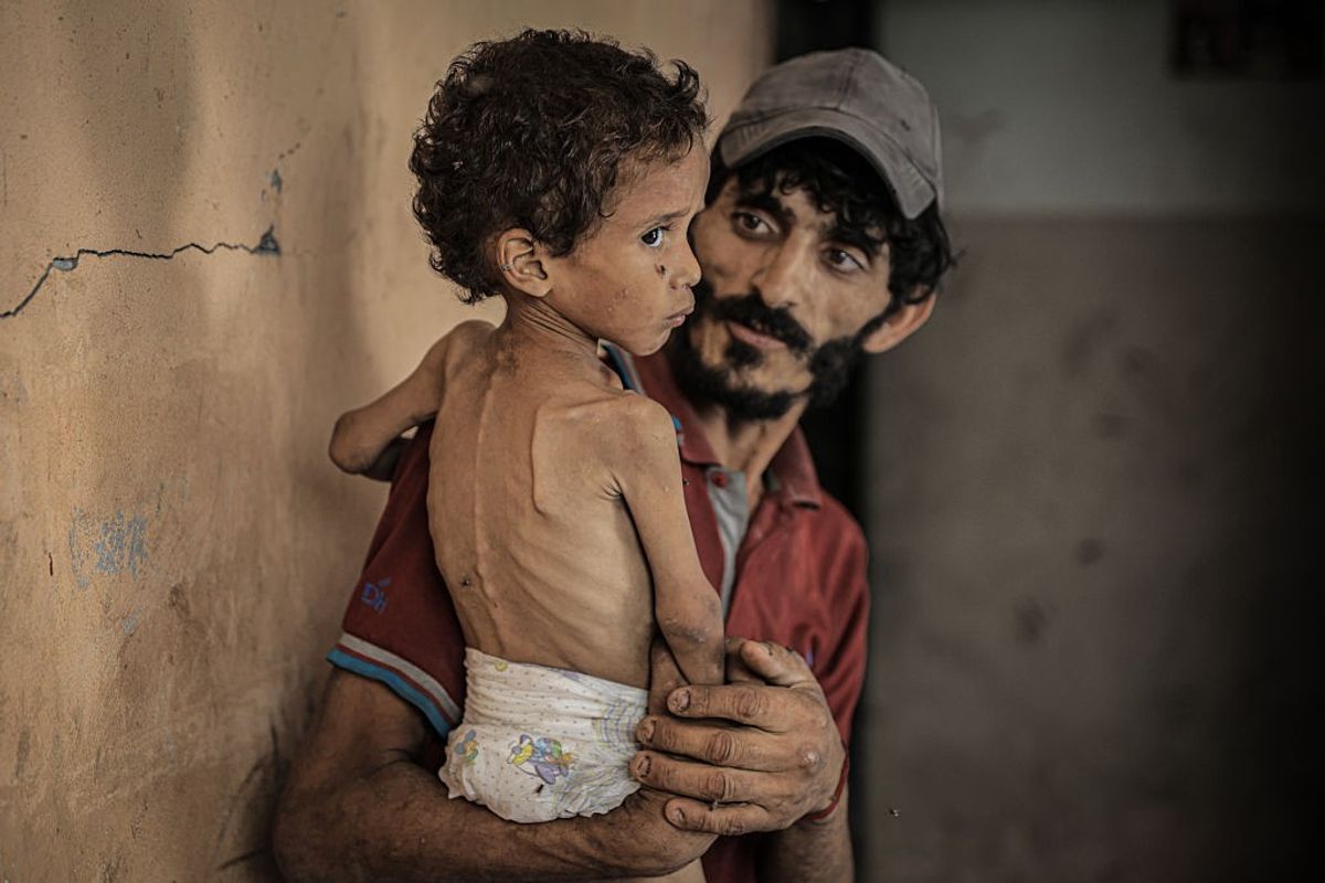 Völkermordleugner bezeichnen den Hunger in Gaza als „Schwindel“ und ...