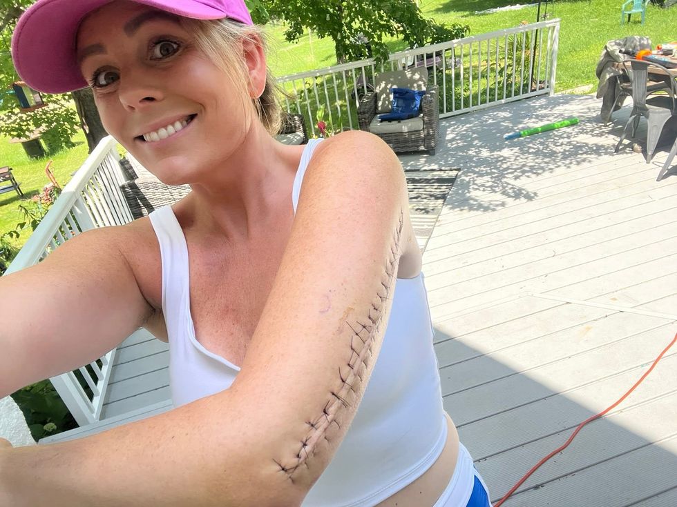 Woman with terminal brain tumor shares her truly inspiring outlook on finding meaning in life