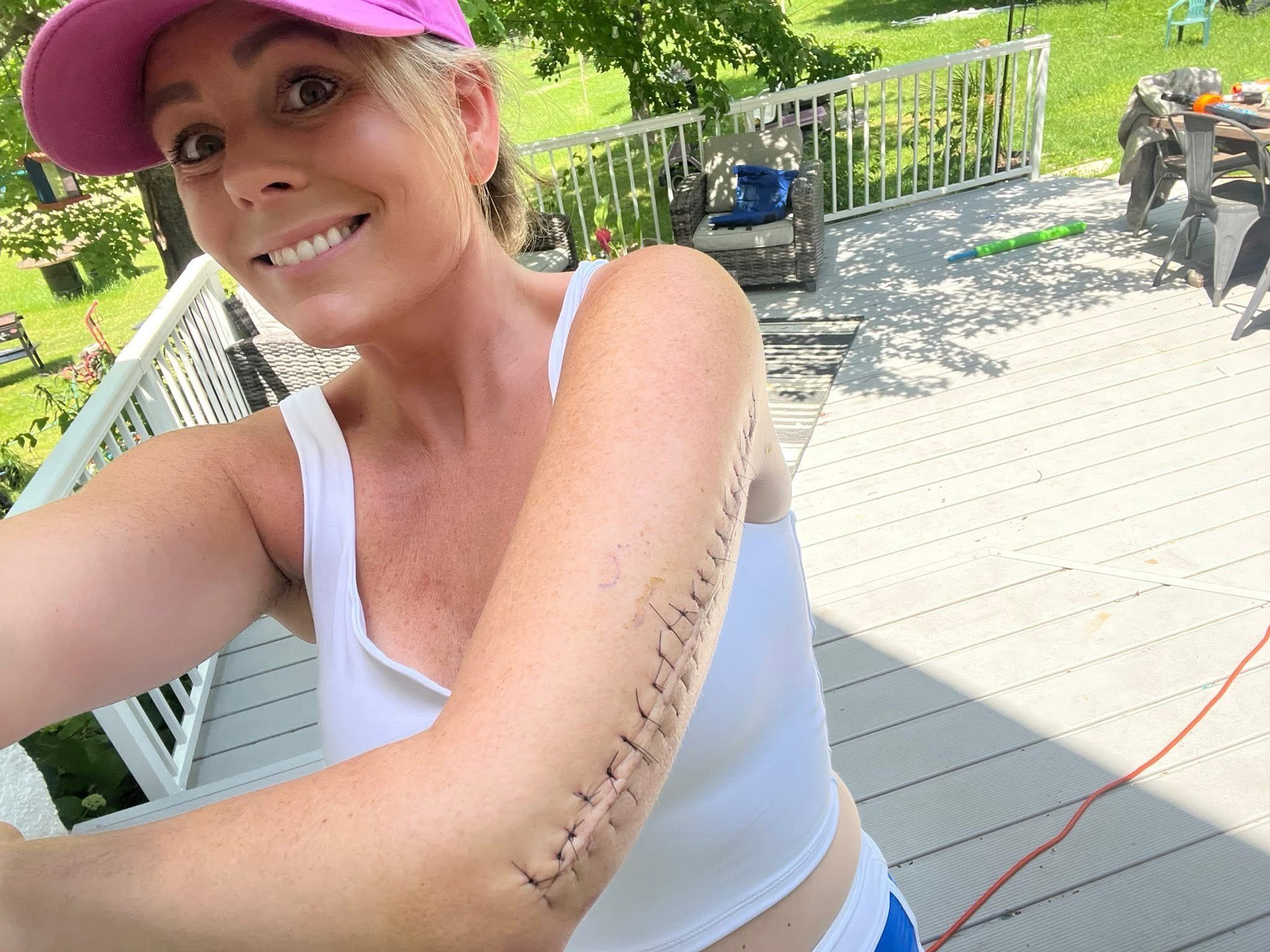 Amber Stratton, cancer, brain tumor, living