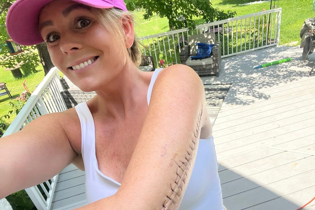 Amber Stratton, cancer, brain tumor, living