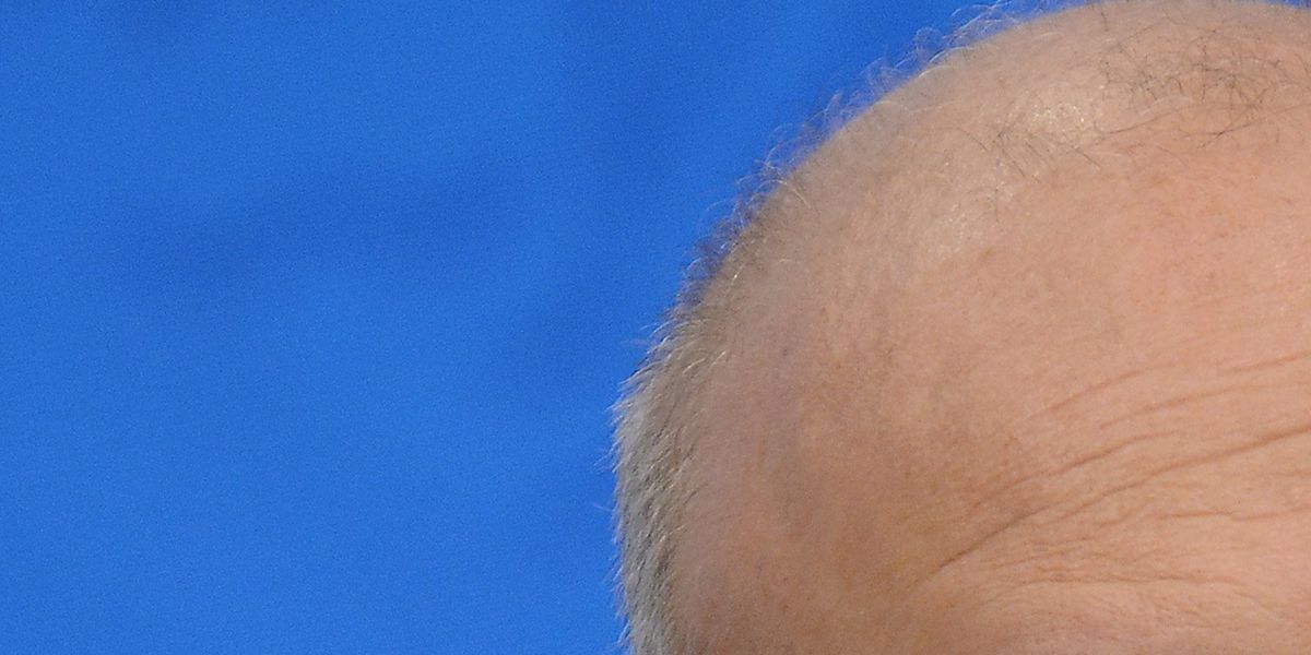 Anche Salvini e Lollobrigida adesso scaricano Schillaci