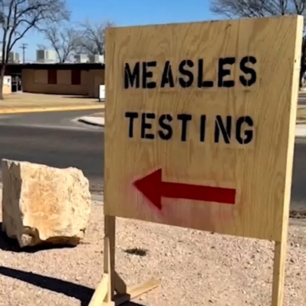 measles testing