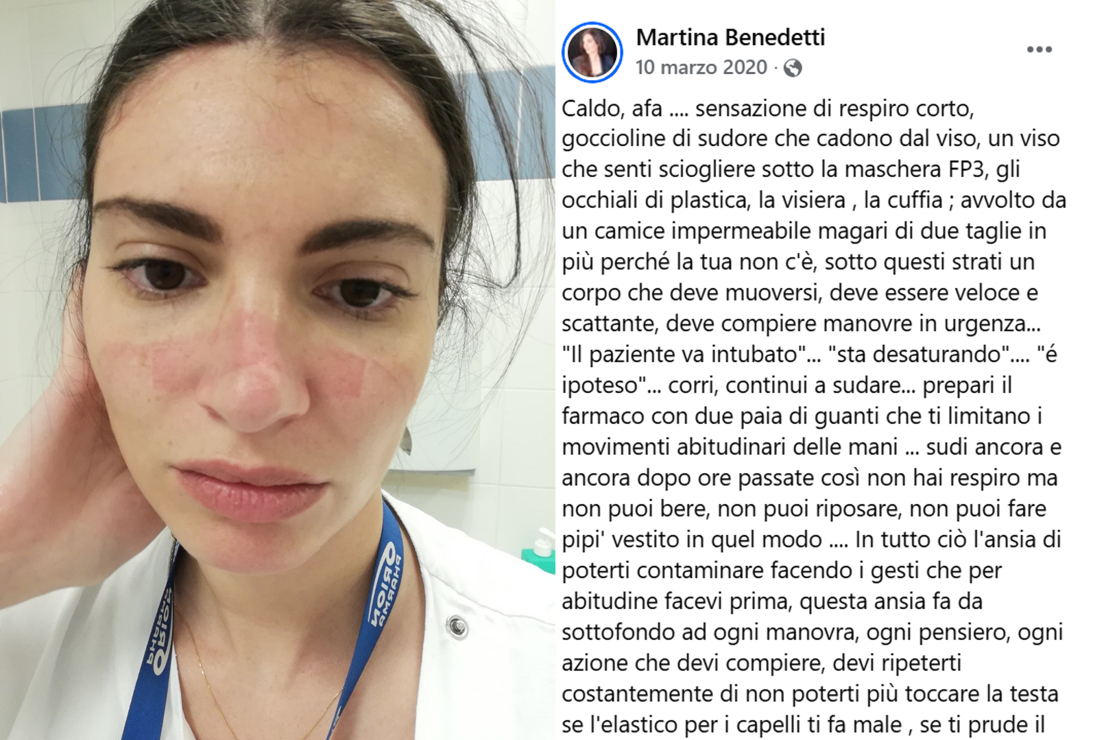 Gimbe arruola pure l’infermiera influencer