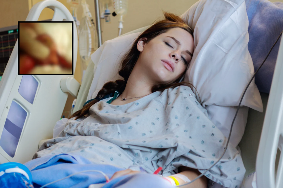teratoma, ovarian cyst, women's health, viral TikTok, Savannah Stuthers, medical story, patient advocacy, tumor with teeth, health education, gynecology