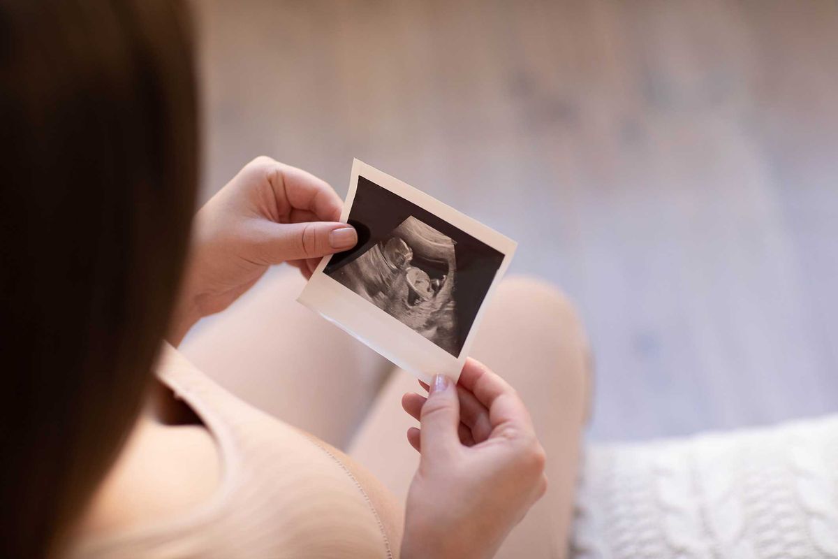 Il mondo spinge l’aborto e oscura i pro life