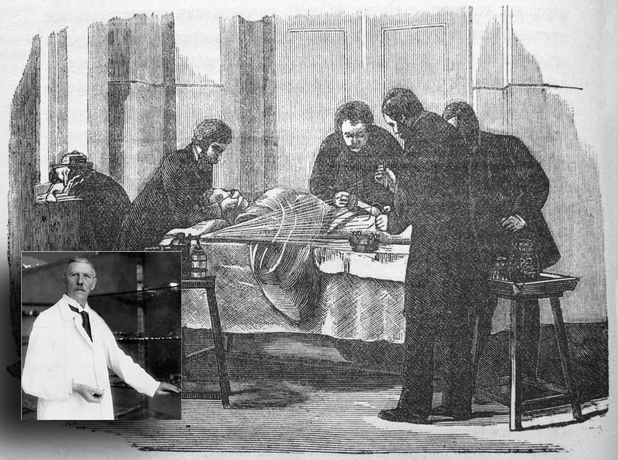 1896: cronaca della prima operazione chirurgica a cuore aperto