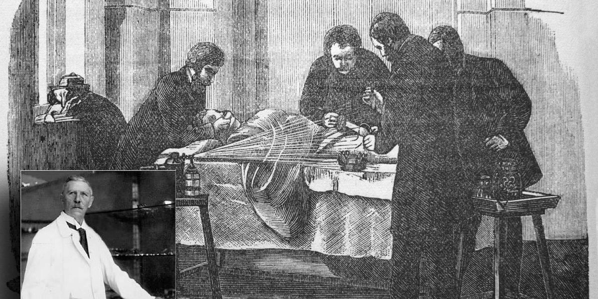 1896 cronaca della prima operazione chirurgica a cuore aperto