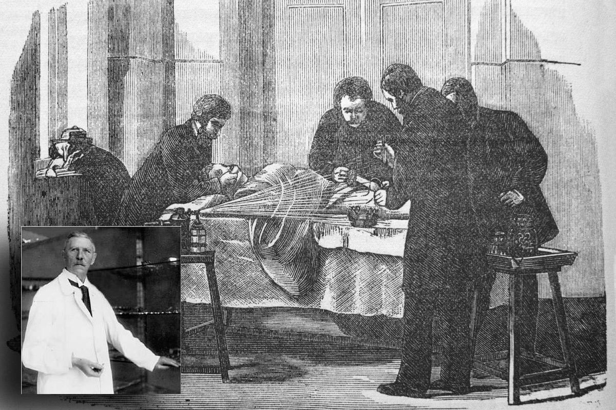 1896: cronaca della prima operazione chirurgica a cuore aperto