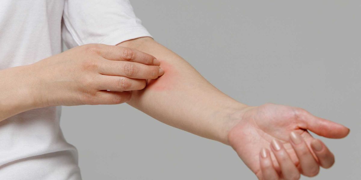 Dai cibi all’acqua, il nichel è ovunque. Ecco quando potrebbe farci male Dai cibi all’acqua, il nichel è ovunque. Ecco quando potrebbe farci male