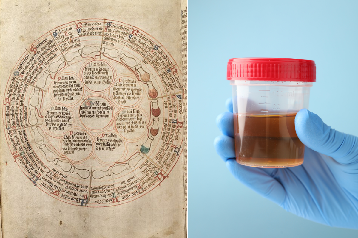 urine, urinalysis, pee, doctors, medicine, healthcare, wellness, reddit, reddit confessions, weird