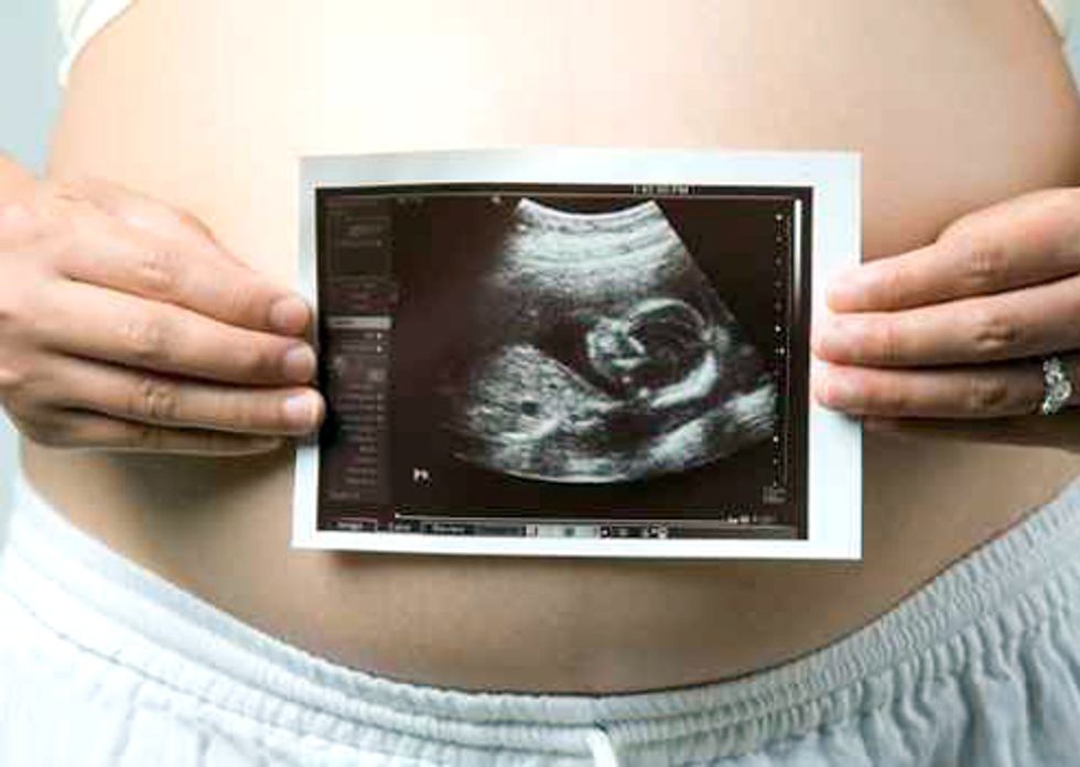 Estimating Chemical Risk to Neurodevelopment of Children