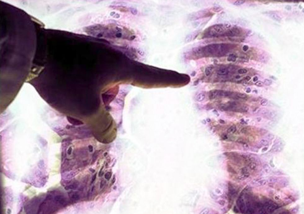 Asbestos Victims Will Drown in Red Tape if Congressional Proposal Passes