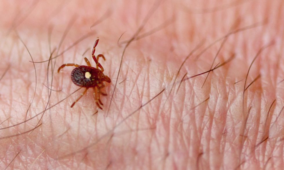 Are Tick Bites Causing Your Food Allergies?