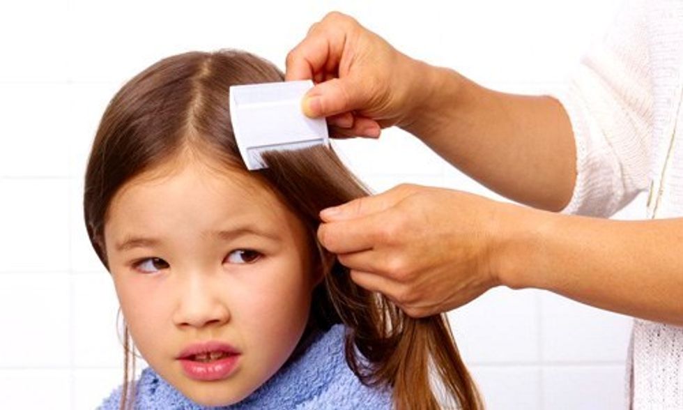 Back-to-School Warning: Head Lice Now Resistant to Treatment in 25 States