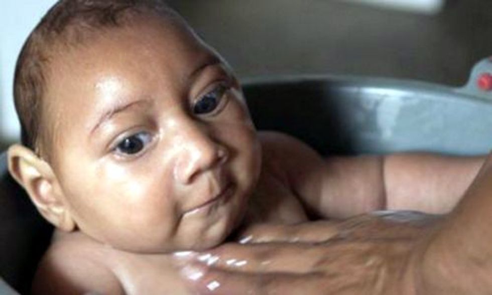 Zika Virus 'Spreading Explosively' in Americas