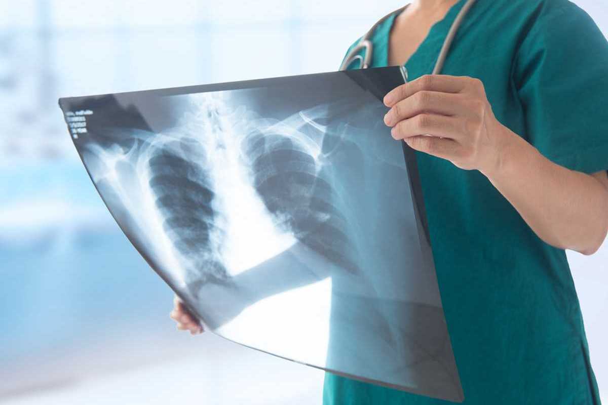 Radiografie false con l’intelligenza artificiale: l’allarme su truffe e risarcimenti