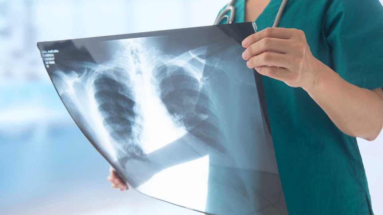 Radiografie false con l’intelligenza artificiale: l’allarme su truffe e risarcimenti