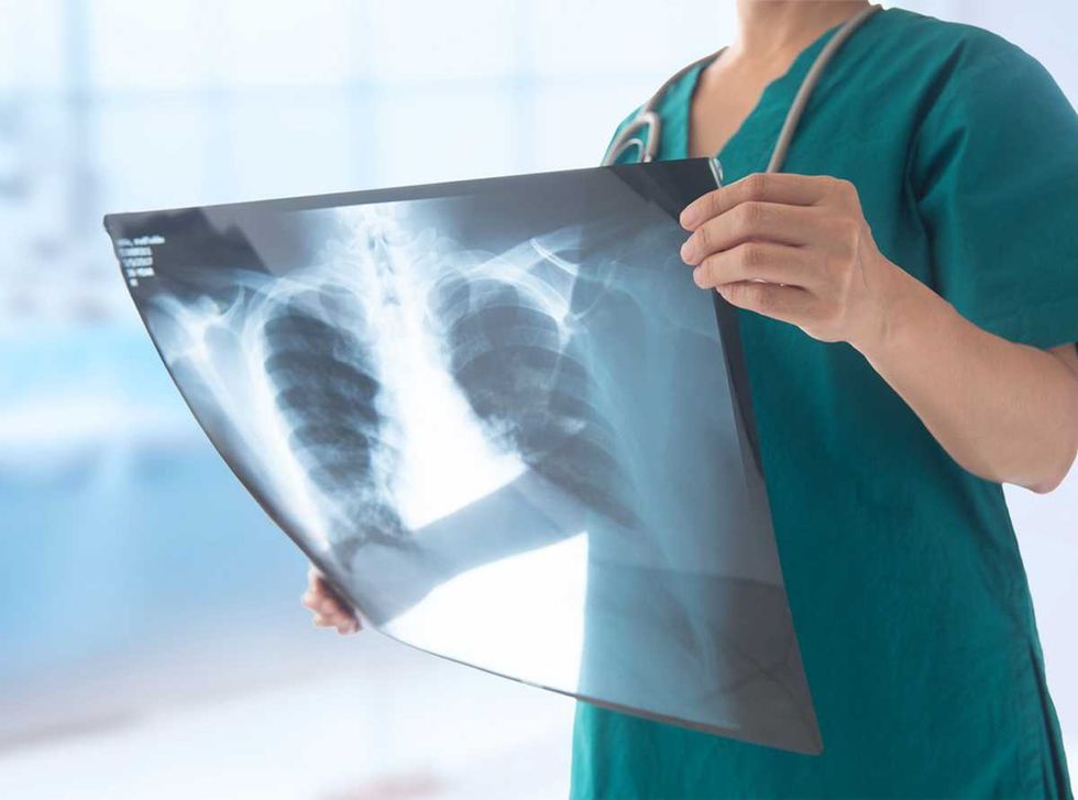 Radiografie false con l’intelligenza artificiale: l’allarme su truffe e risarcimenti