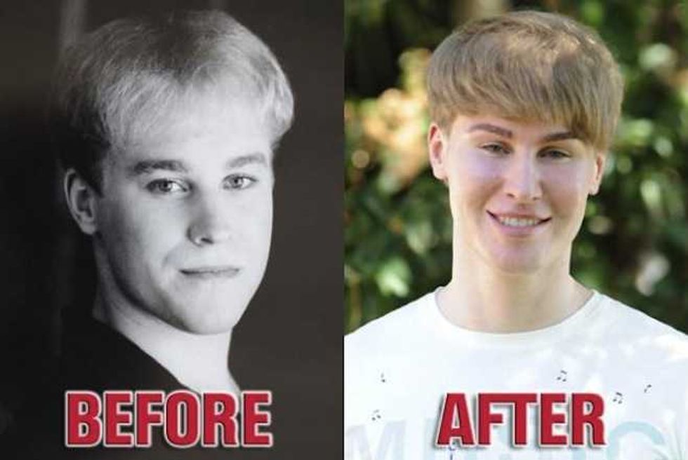 Would You Spend $100,000 to Look Like Justin Bieber? This Guy Did