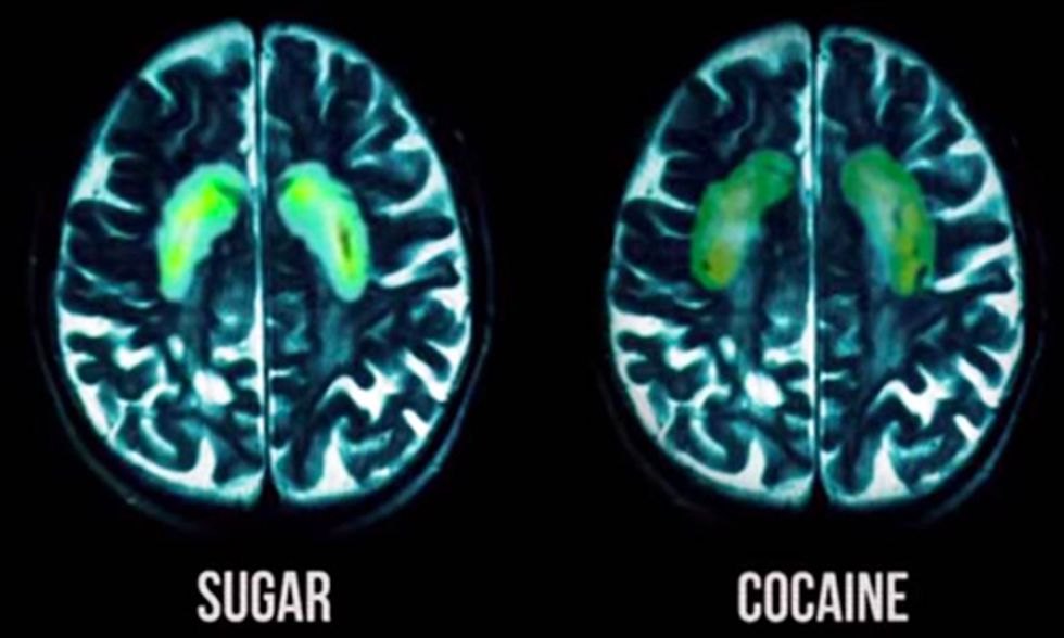 Quitting Sugar Is as Tough as Kicking a Cocaine Habit
