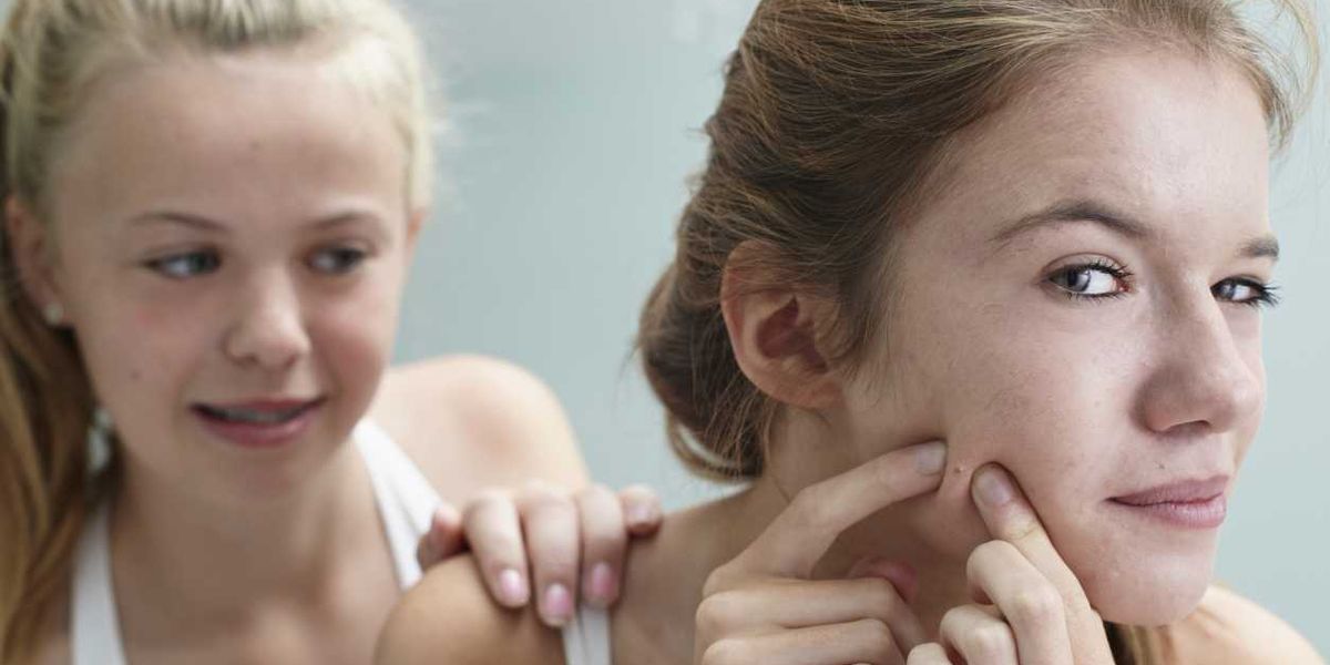 Parents, Don’t Throw the Kitchen Sink at Acne Why Treating with Less