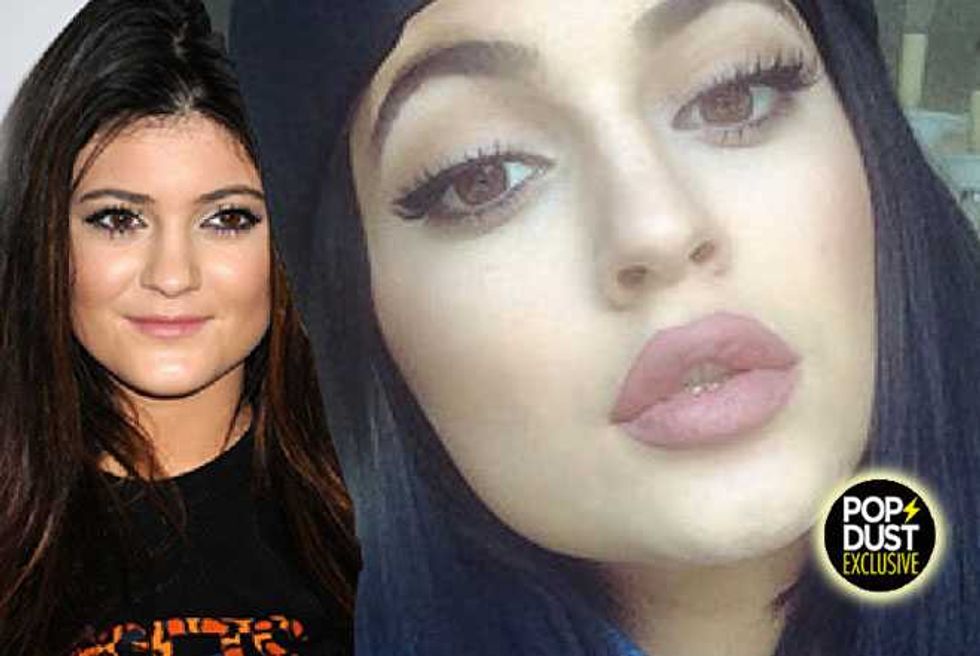 Kylie Jenner’s Keeping Up With The Fillers—But Wants To Look ’Natural’