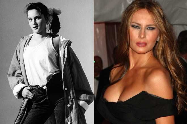 Мелания Трамп В Молодости Фото До Пластики