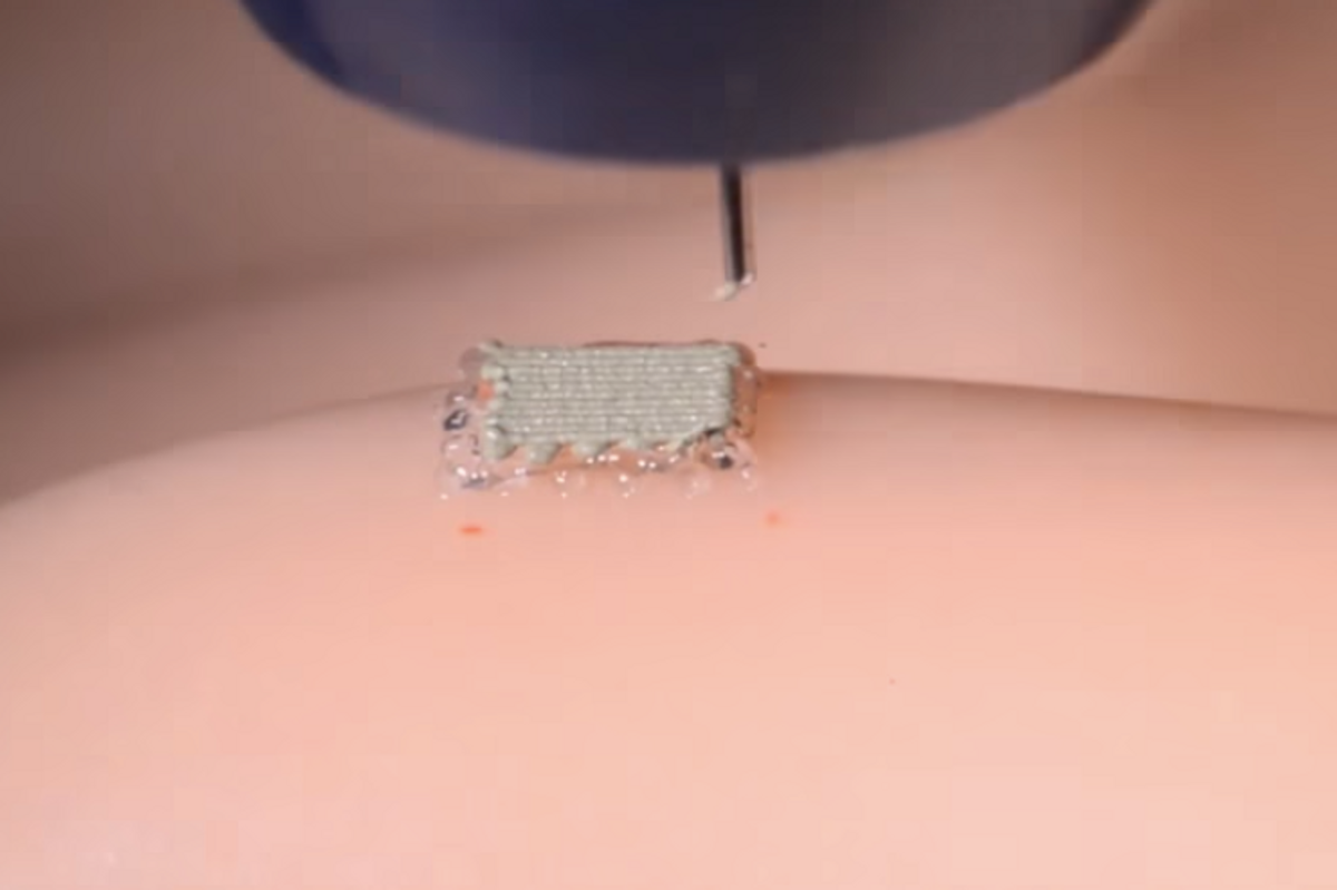 Scientists print 3D stretchable "bionic skin"