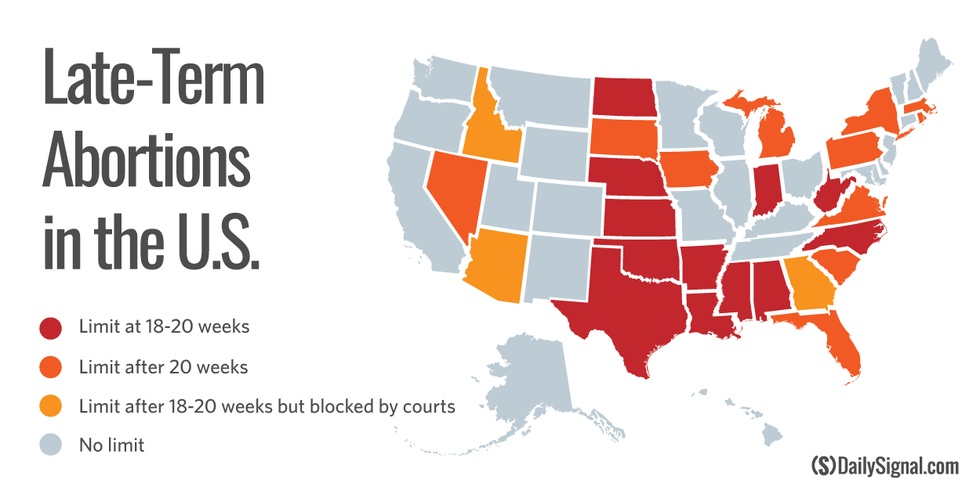 The Facts About Late-Term Abortions