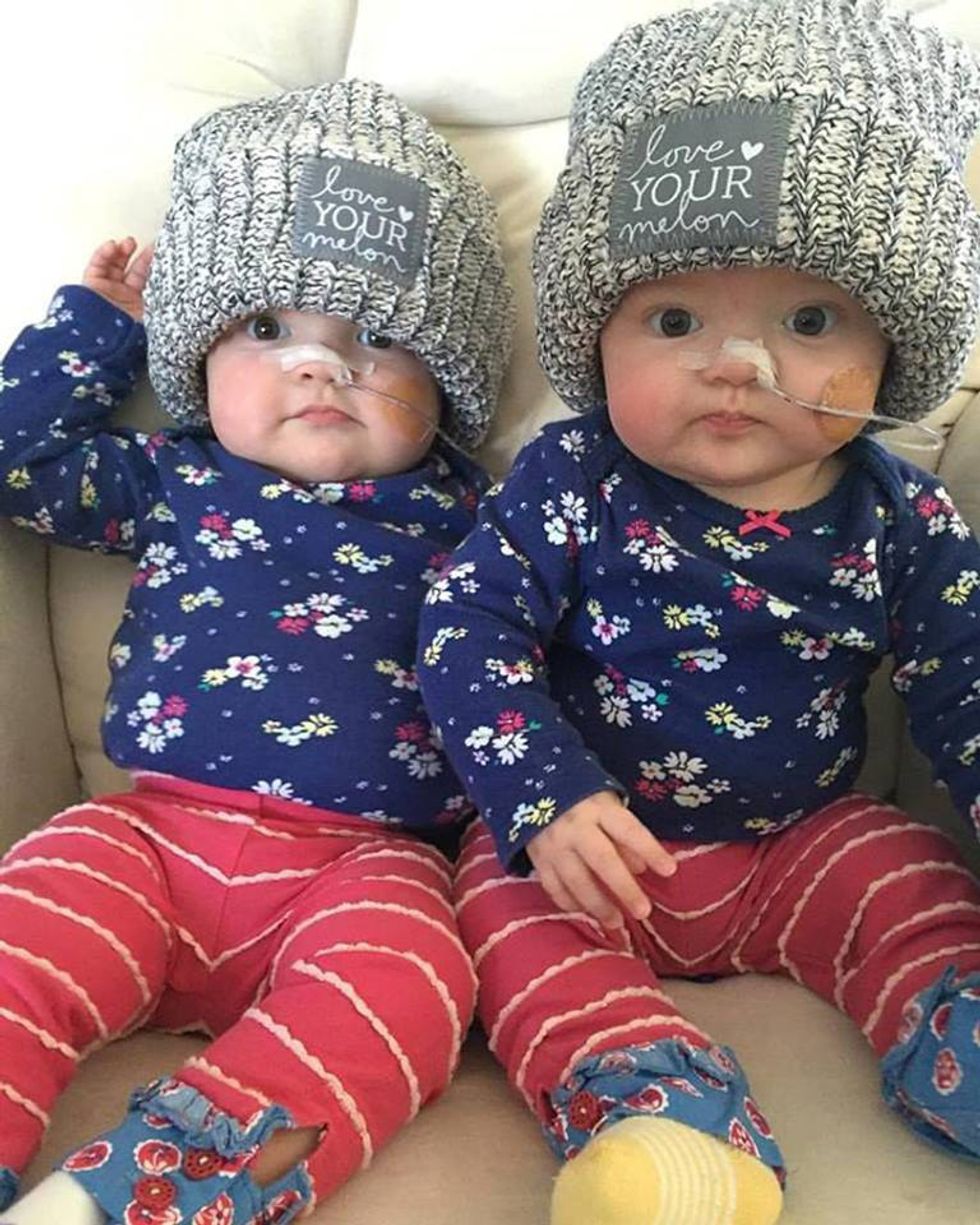 Why You Should Love Your Melon