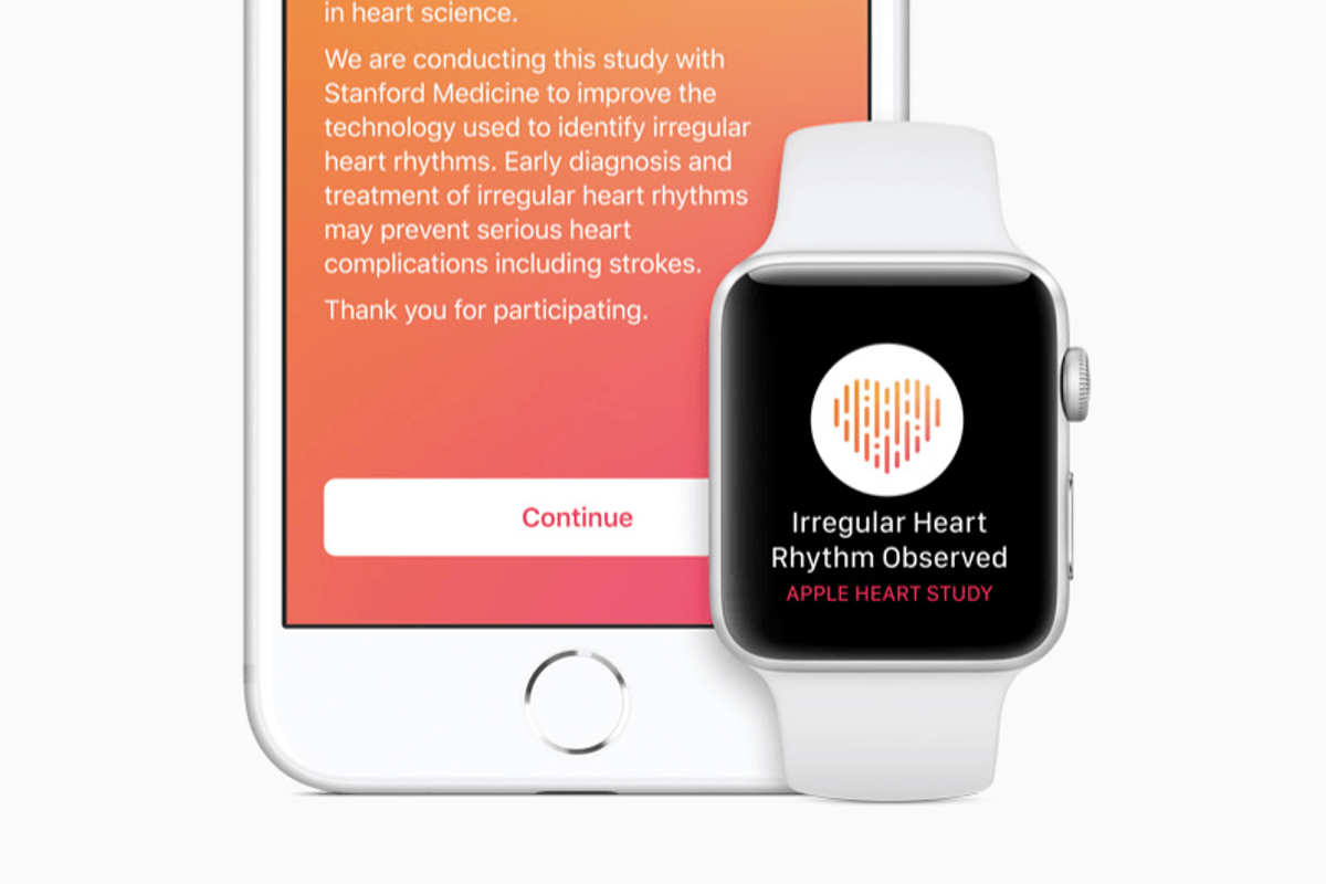 Apple launches Watch app to help detect heart beat irregularities