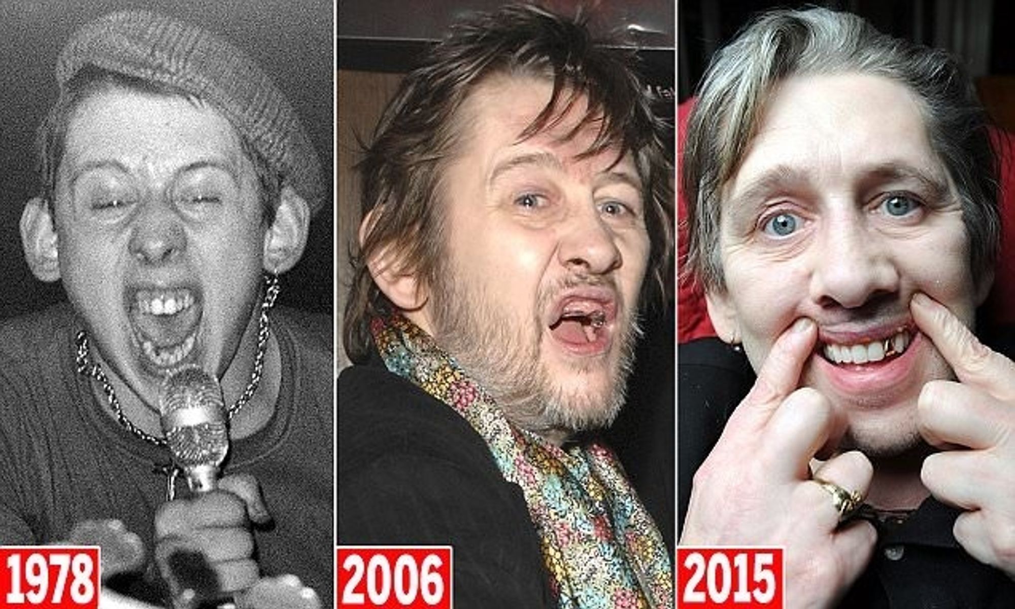 Shane MACGOWAN В молодости