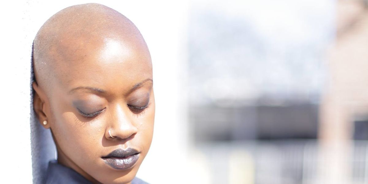 My Struggle With Alopecia: How I Learned To Find the Beauty In My Baldness