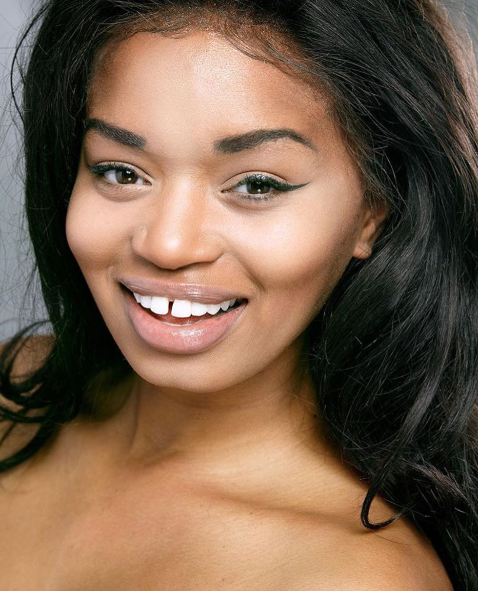 Real Women Share How They Learned To Embrace Their Gap Teeth